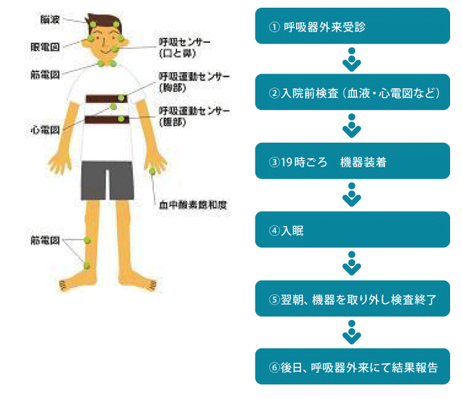 呼吸器内科：ポリソムノグラフィー検査の流れ